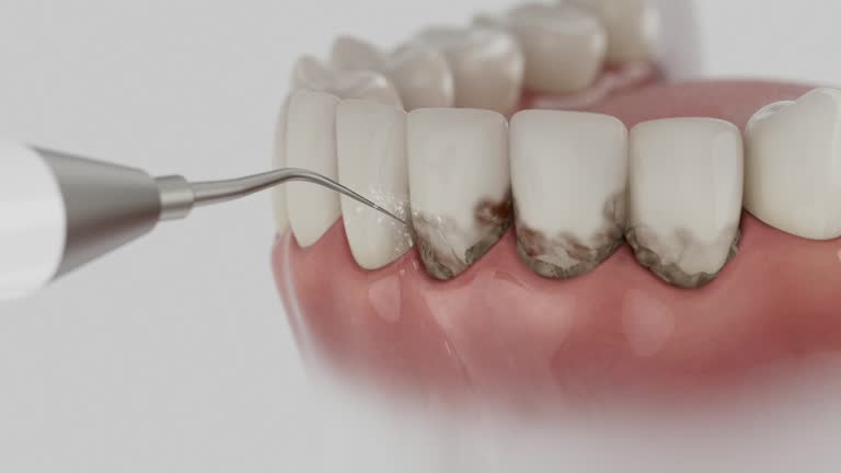 Reliable Dental contractor in La Crescenta-Montrose, CA by Dentist Open Now